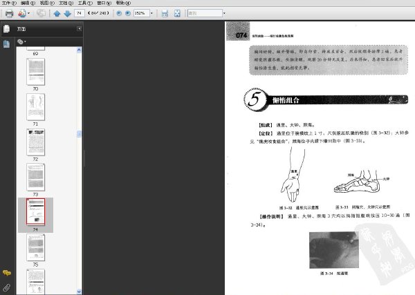 指到病除：指針按摩急救圖解..jpg