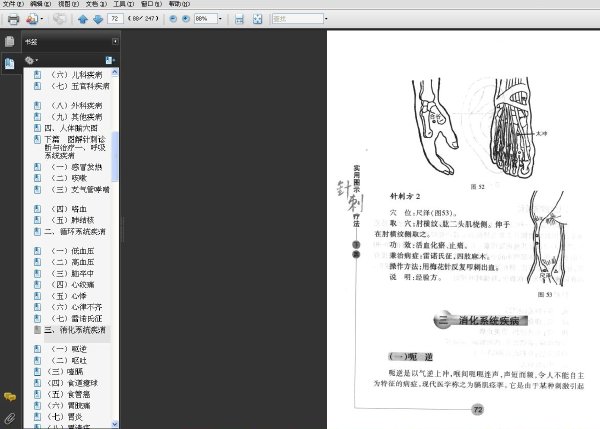 實用圖示針刺療法.jpg