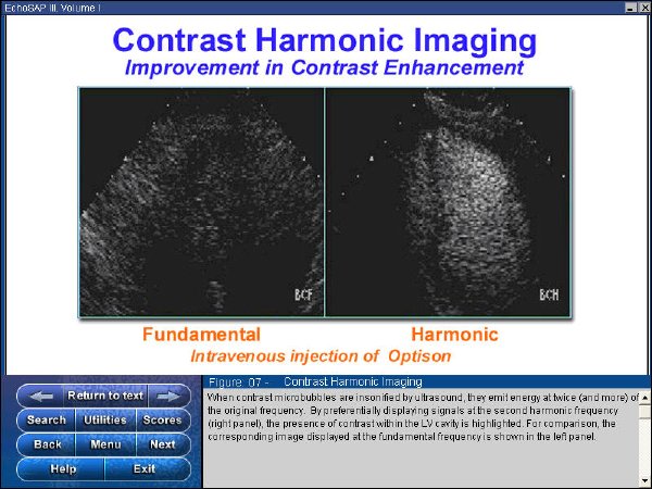 IPB Image